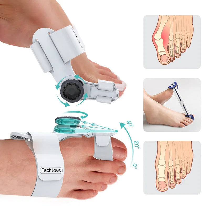Upgraded Bunion Corrector - 3D Knob Toes Corrector