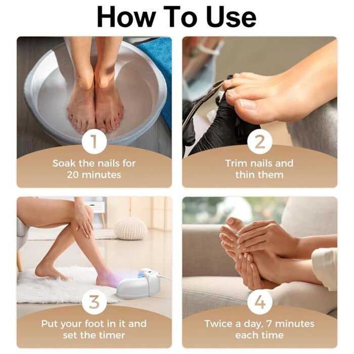 Nail Fungus Laser Treatment Device