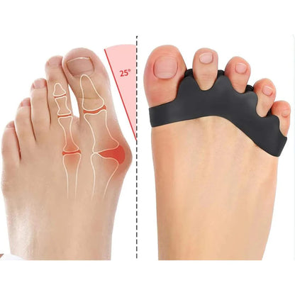 Toe Spacer | Toe Realignment and Pain Relief – Ideal for Bunions - Overlapping Toes - and Foot Comfort