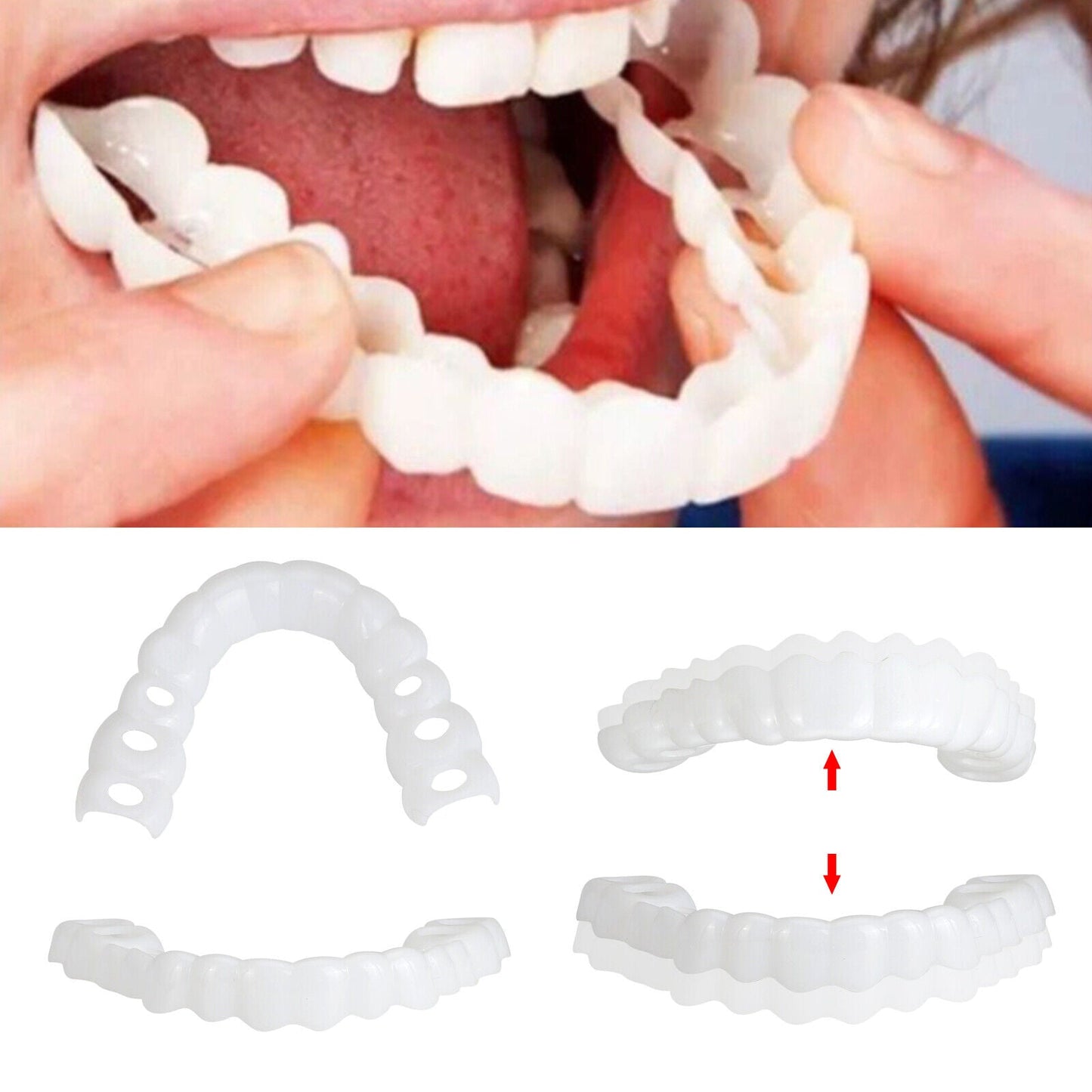 Smile Veneers (Upper & Lower)