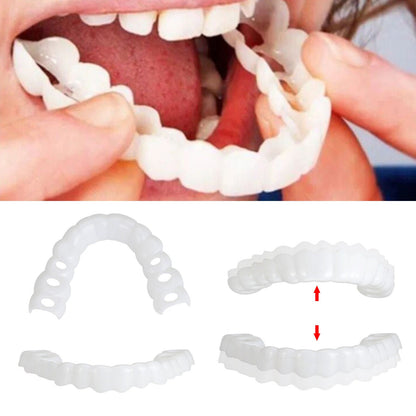 Smile Veneers (Upper & Lower)