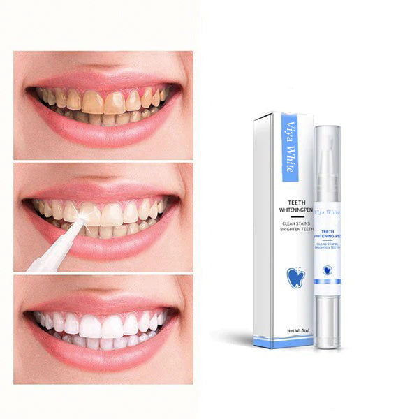 Effective Home Smile Whitening System - OutfitLondon