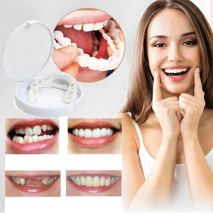Comfortable Clip On Smile Veneers for Upper and Lower Teeth - OutfitLondon