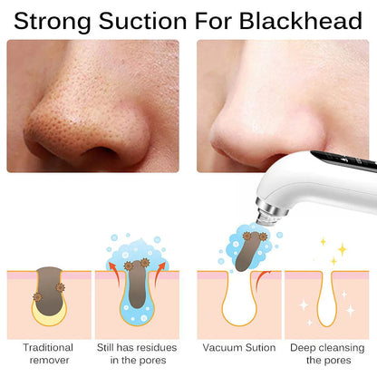 Professional Nose Blackhead Remover Vacuum - Deep Cleansing with Suction Technology