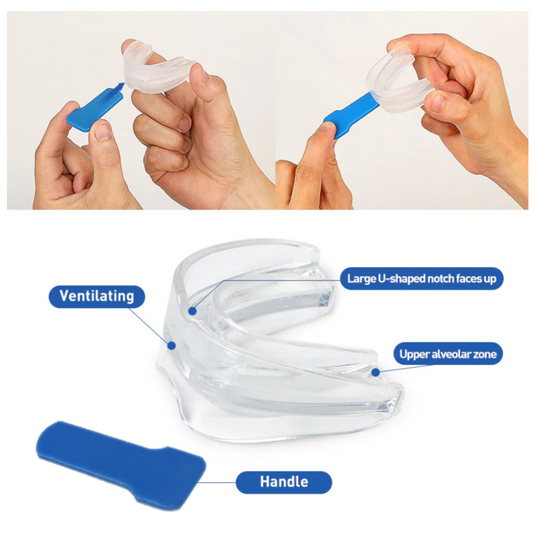 Snore Stopper Mouthguard