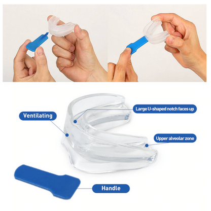 Snore Stopper Mouthguard