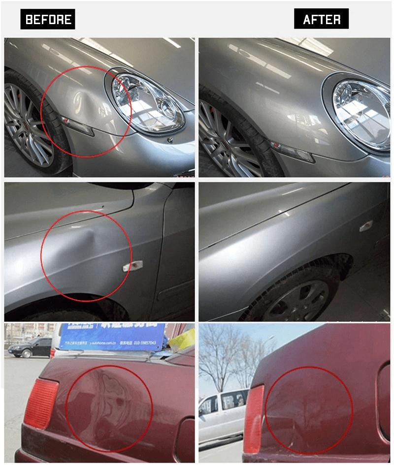 Paintless Car Dent Remover Tool - Remove Car Dents Quickly
