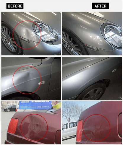 Paintless Car Dent Remover Tool - Remove Car Dents Quickly