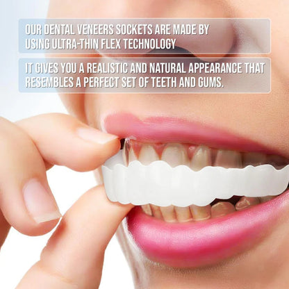 Smile Veneers (Upper & Lower)