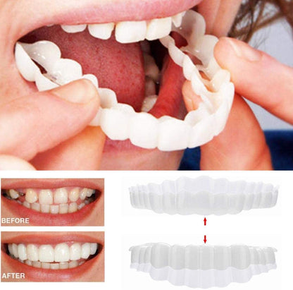 Complete Teeth Veneer Kit Upper Lower Set