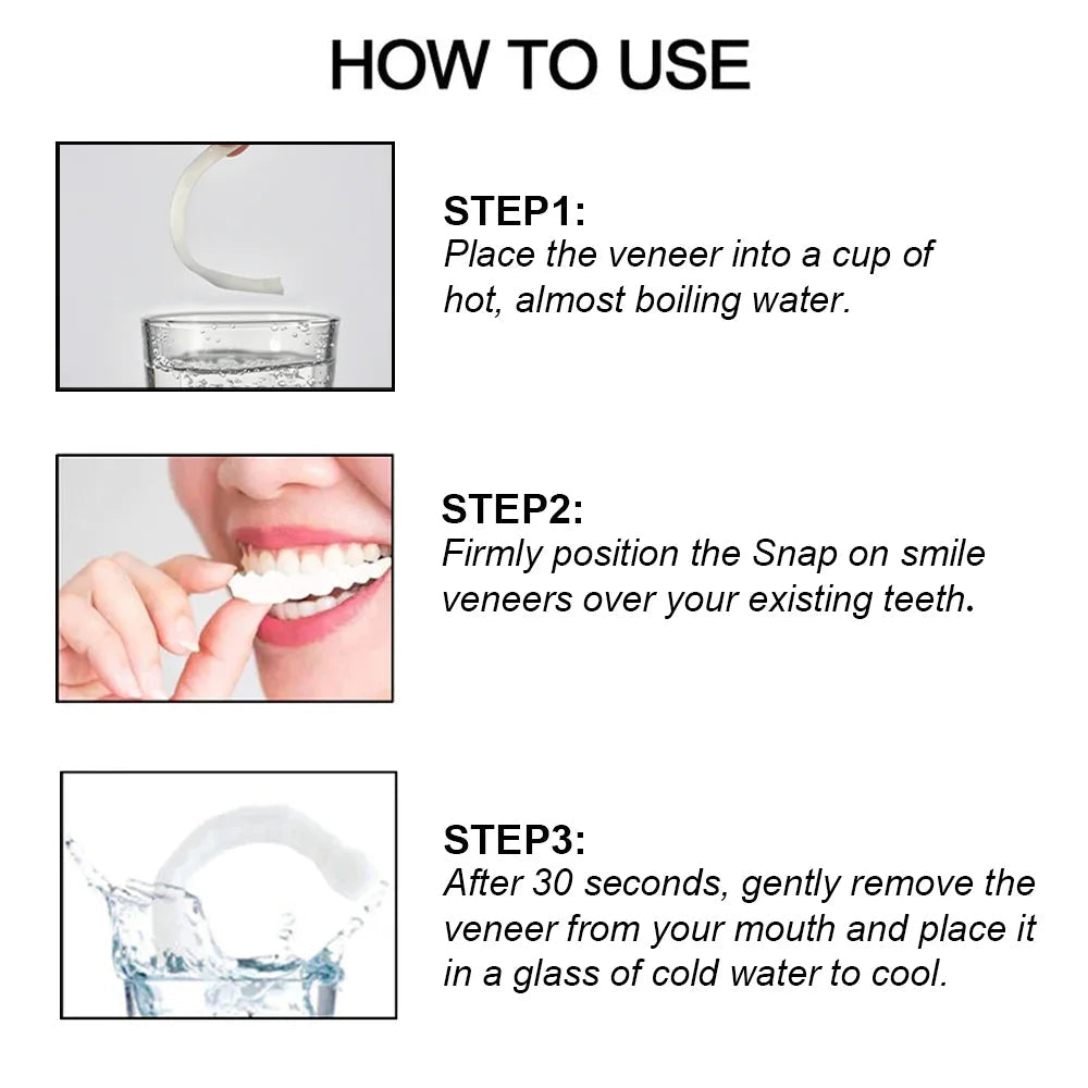Smile Veneers (Upper & Lower)