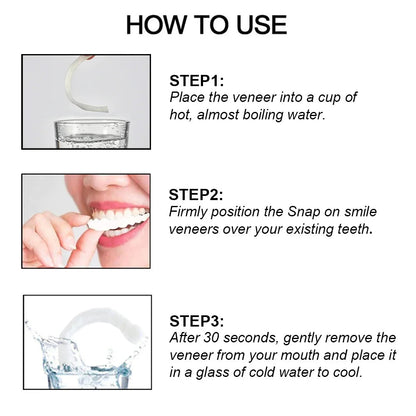 Smile Veneers (Upper & Lower)