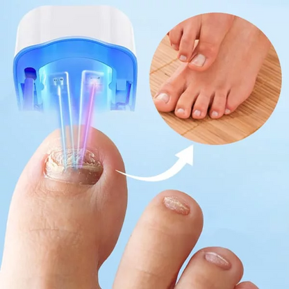 Nail Fungus Cleaning Laser Device