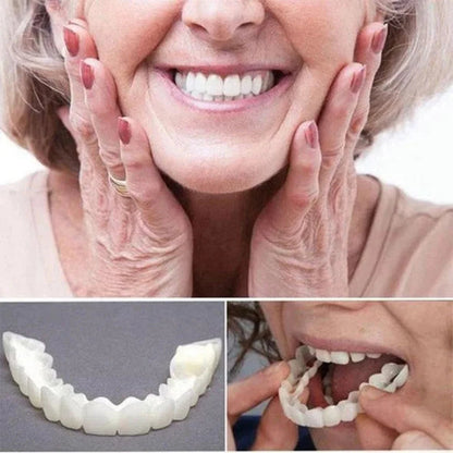 Smile Veneers (Upper & Lower)