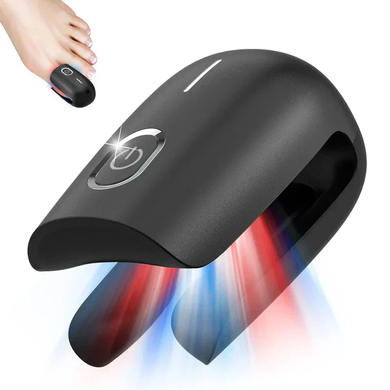 Portable At Home Nail Laser Device USB Rechargeable - OutfitLondon