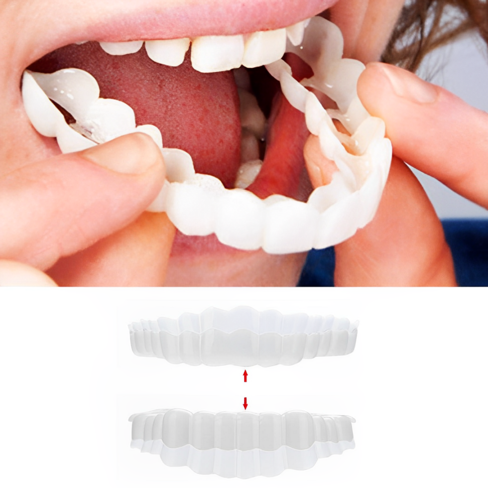 Complete Teeth Veneer Kit Upper Lower Set - OutfitLondon