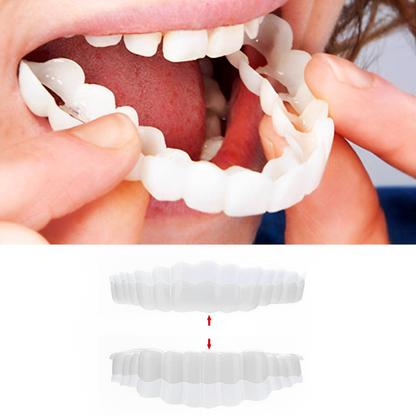 Complete Teeth Veneer Kit Upper Lower Set - OutfitLondon