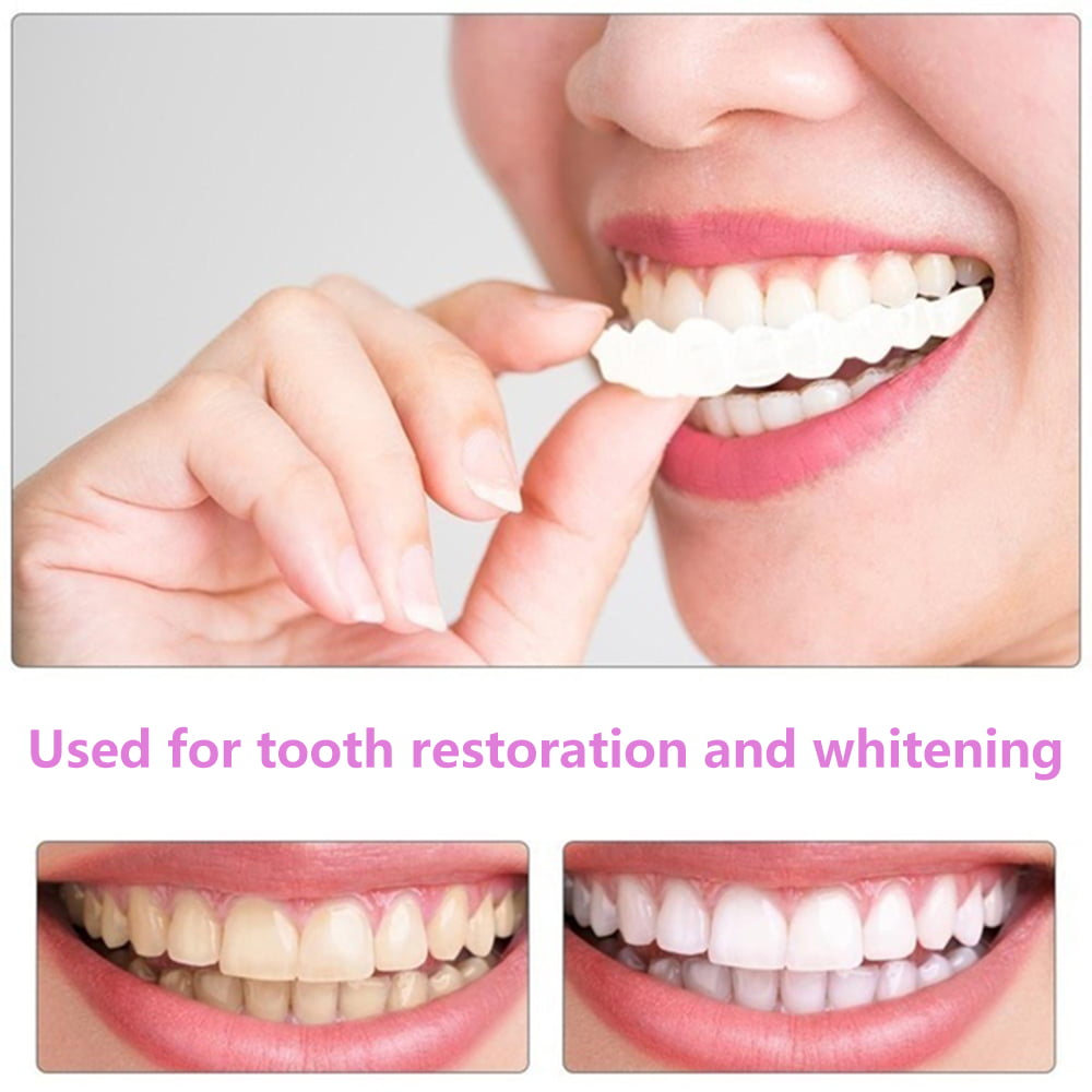 Smile Veneers (Upper & Lower)
