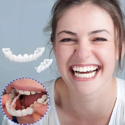 Smile Veneers (Upper & Lower)