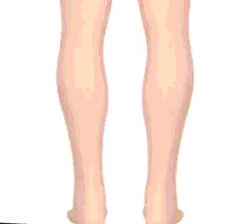 Comfort Orthopedic Sandals