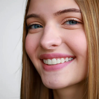 Smile Veneers (Upper & Lower)