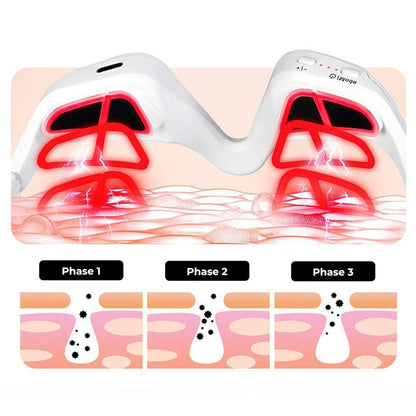 Revital Eyes Under-eye Red Light Therapy, Reduces Puffiness & Dark Circles, Targets Fine Lines nd Wrinkles