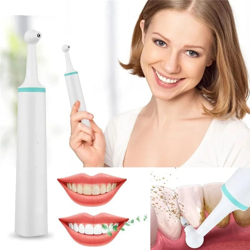 Fast Electric Tooth Plaque Remover For Clean Smile - OutfitLondon