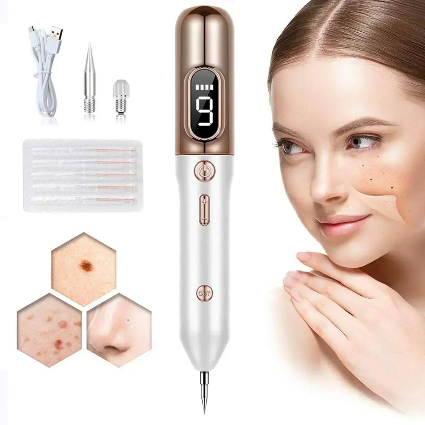 Advanced At-Home Skin Tag Remover Plasma Pen Kit - OutfitLondon